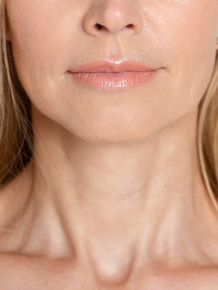 Neck Lift - Boise Plastic Surgery Neck Lift - Boise Plastic Surgery