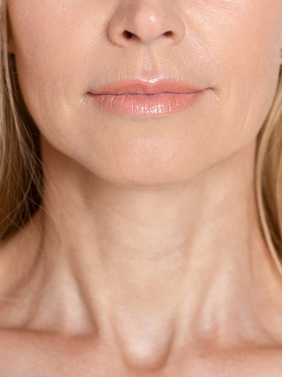 Neck Lift - Boise Plastic Surgery